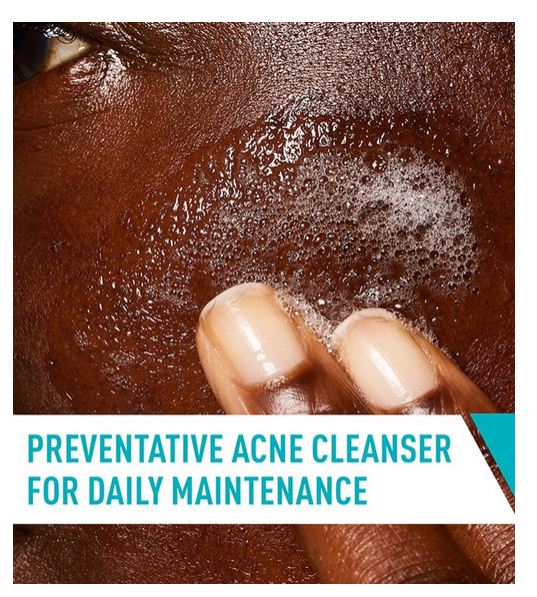 Cerave Acne Control Cleanser