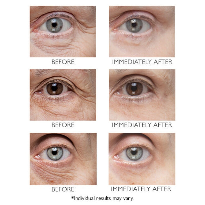 PETER THOMAS ROTH Instant FIRMx Eye Temporary Eye Tightener